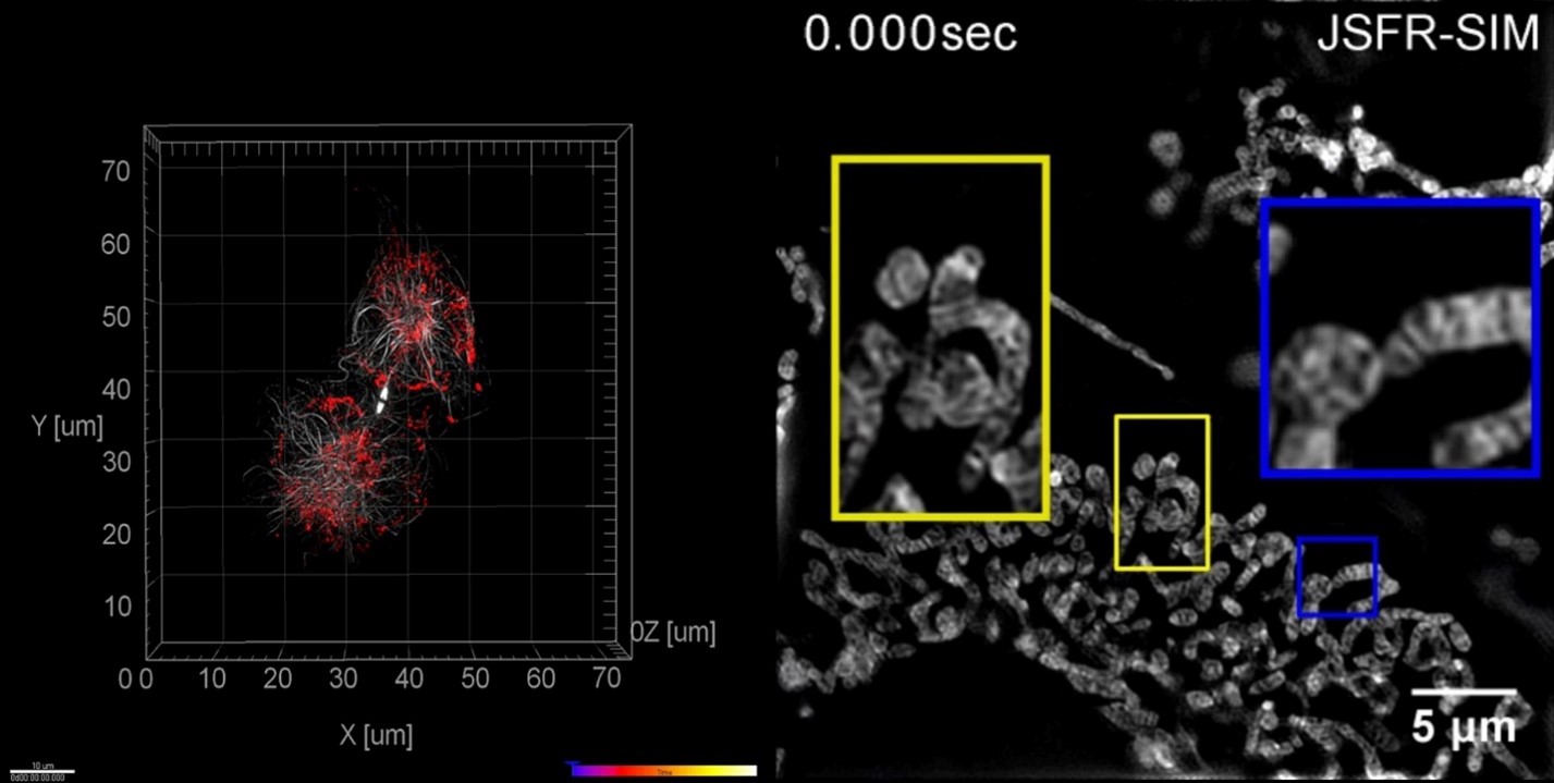 Superresolution structured illumination microscopy 