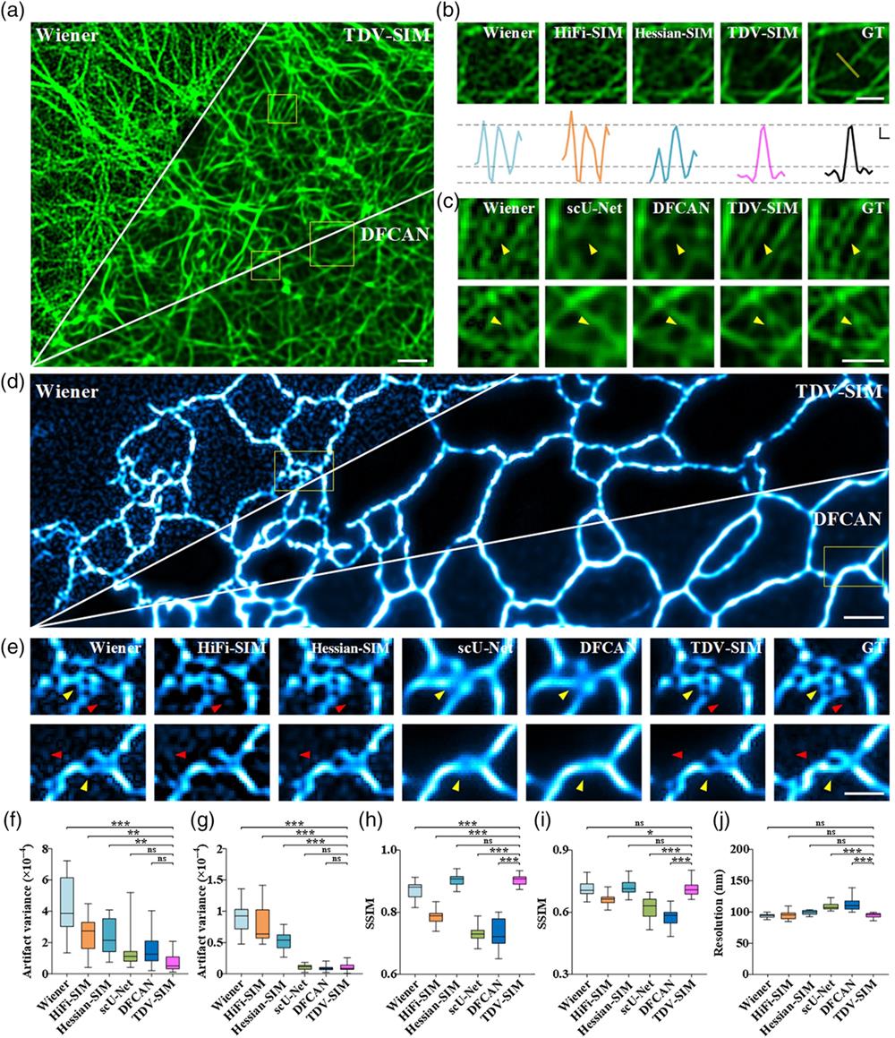 TDV-SIM outperforms other reconstruction algorithms in suppressing artifacts and hallucinations while maintaining resolution. (a) Actin filaments under the SR-SIM. (b) Magnified views of the larger boxed region in panel (a) reconstructed by Wiener deconvolution, HiFi-SIM, Hessian-SIM, and TDV-SIM. The GT image is shown as the reference. Profiles along the yellow line are on the bottom. (c) Magnified views of the smaller boxed regions in panel (a) reconstructed by Wiener deconvolution, scU-Net, DFCAN, and TDV-SIM. The GT images are shown as references. (d) Time series imaging of ER under the SR-SIM (Video 1, MP4, 45 MB [URL: https://doi.org/10.1117/1.APN.2.1.016012.s1]). (e) Magnified views of the boxed regions in panel (d) reconstructed by Wiener deconvolution, HiFi-SIM, Hessian-SIM, scU-Net, DFCAN, and TDV-SIM. The GT images are shown as references. Artifact variances of actin filaments (f) or ER tubules (g) from background regions in different reconstructions (n=15 from three cells for each sample). Yellow arrowheads in panels (c) and (e) indicate the inaccurate reconstructions of pure DL-based methods. Red arrowheads in panel (e) highlight the artifacts of physical-model-based methods. SSIM of actin filaments (h) and ER tubules (i) in different reconstructions (n=150 and 15, respectively). (j) Resolutions of different reconstructions of actin filaments in panels (a)–(c) (n=14 from three cells). Scale bars: (a) and (d) 1 μm; (b) top, (c) and (e) 0.5 μm. (b) Bottom, axial: 0.2 arbitrary units (a.u.); lateral: 0.1 μm. Data are shown as mean ± SEM. p<0.05*, p<0.01**, p<0.001***, ns: not significant (one-way ANOVA).