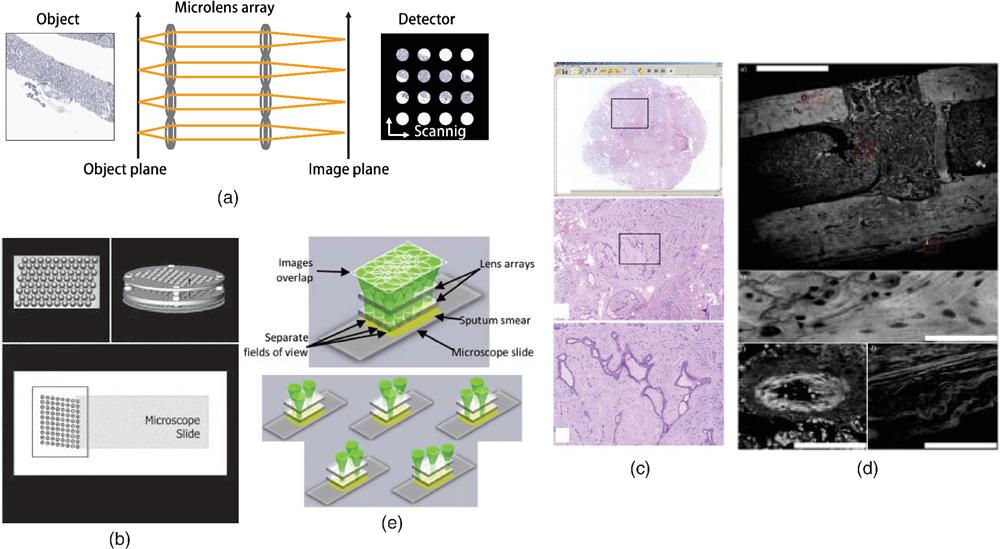 Array microscopy. (a) Images are captured through parallelized microimaging systems. (b) Schematics of an array microscopy for digital histopathology. In their system, three lenslet arrays are stacked. Each lens group has a diameter of 1.5 mm and a working distance of 400 μm. The microlenses are densely packed, and the orientation of the array is slightly tilted to the scanning axis. Therefore, a single-axis scan can provide the whole FOV. (c) Images of a pathology slide with a high SBP (∼109). (d) Image of a fluorescently stained rat femur (upper) and its enlarged view (bottom) with parallelized scanning fluorescent microscopy. The scale bar for the top image is 1 mm, and the zoom-in images are 80 μm. (e) Sequential illumination of the beam for mechanical scanning-free parallel imaging. Panels (b), (c), (d), and (e) are modified from Refs. 7, 9, and 66, respectively.
