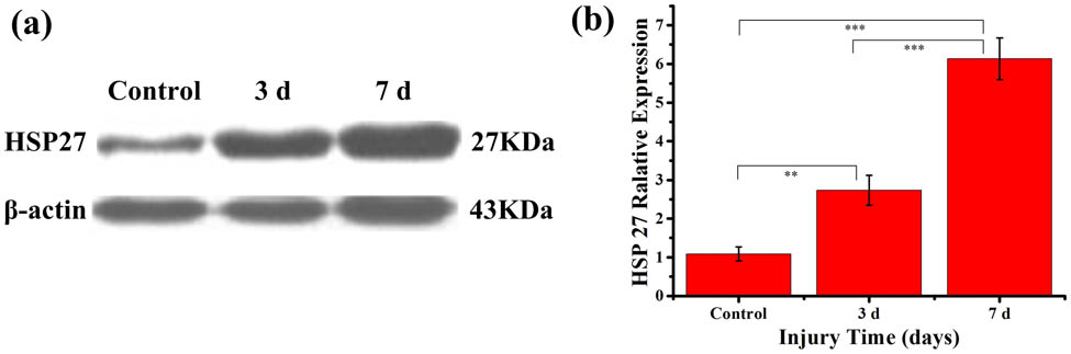 Effect of trauma on the protein expression level of HSP27. (a) Western blot of HSP27 protein in the total lysate collected from the sciatic nerve of naive rats (control) and at 3 and 7 days after trauma (3d, 7d). The treatment induced a time-dependent increase in HSP27 protein levels. Note that the anti-HSP27 antibody recognized a band of 27 kDa in size. The expression of β-actin (43 kDa) was shown as a control for equal protein loading. (b) One-way ANOVA was used to compare differences between control and treated groups. Values of HSP27 protein levels were normalized to β-actin and the data were graphed as mean±S.E.M. **, p<0.01 and ***, p<0.001.