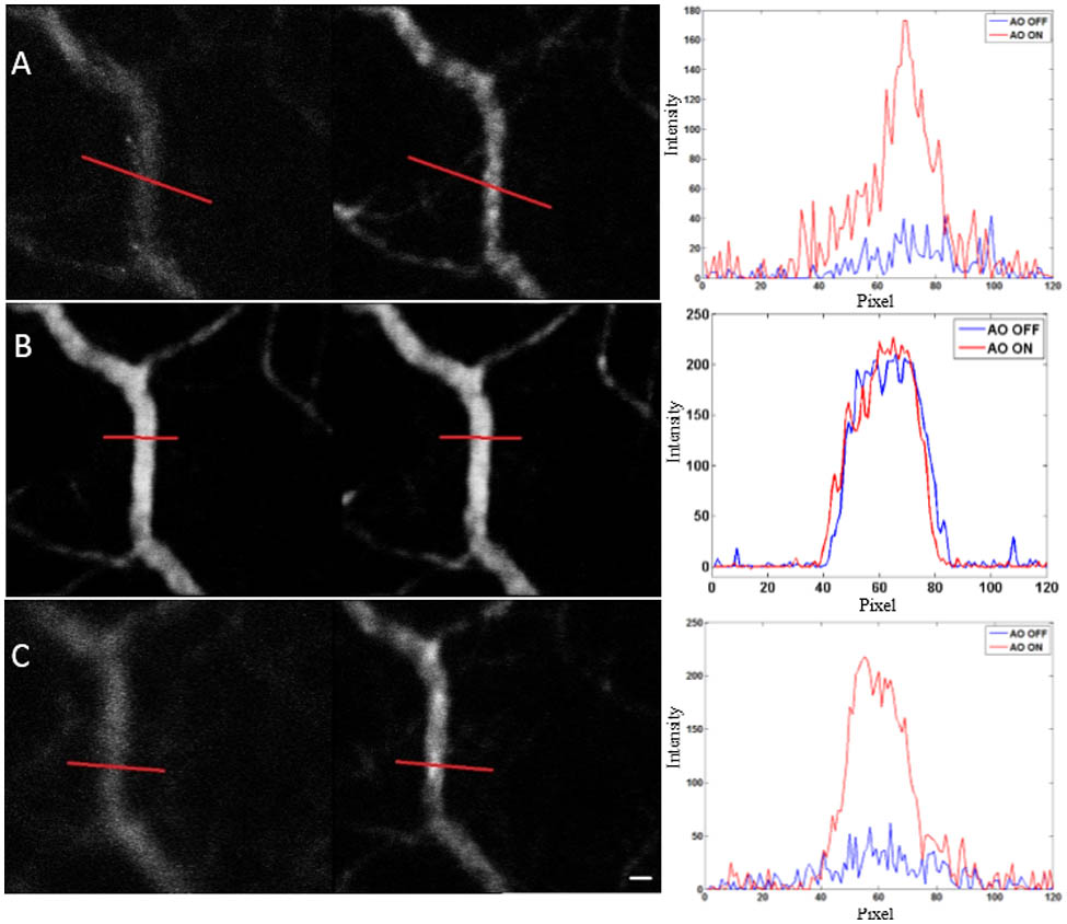 Fluorescence images without and with AO correction at different depth, and fluorescence signal profiles corresponding to each depth: (A) 80, (B) 100, and (C) 120 μm. The image size is 314*314 microns with a scale bar of 10 μm.