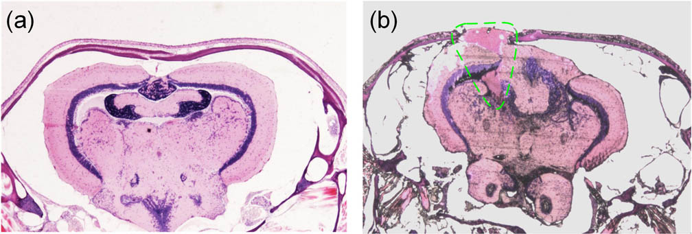 Histological (H&E) study of adult zebrafish head (a) without or (b) with the needle insertion induced brain injury. Both images were generated using a Nikon microscope under a 2 times objective.