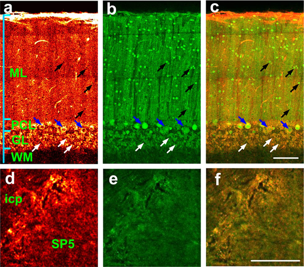(Color online) Combined SHG and TPEF images of the mouse cerebellum and brain stem slices. (a) SHG image shown in hot colormap, (b) TPEF image in green, (c) the merged SHG/TPEF image of the cerebellar cortex. The black, blue, and white arrows indicate the neuron somas in ML, PCL, and GL, respectively. (d)–(f) are the SHG image (hot colormap), TPEF (green), and the merged images SHG/TPEF of icp and SP5. Scale bars in (c) and (f) are 100 μm.
