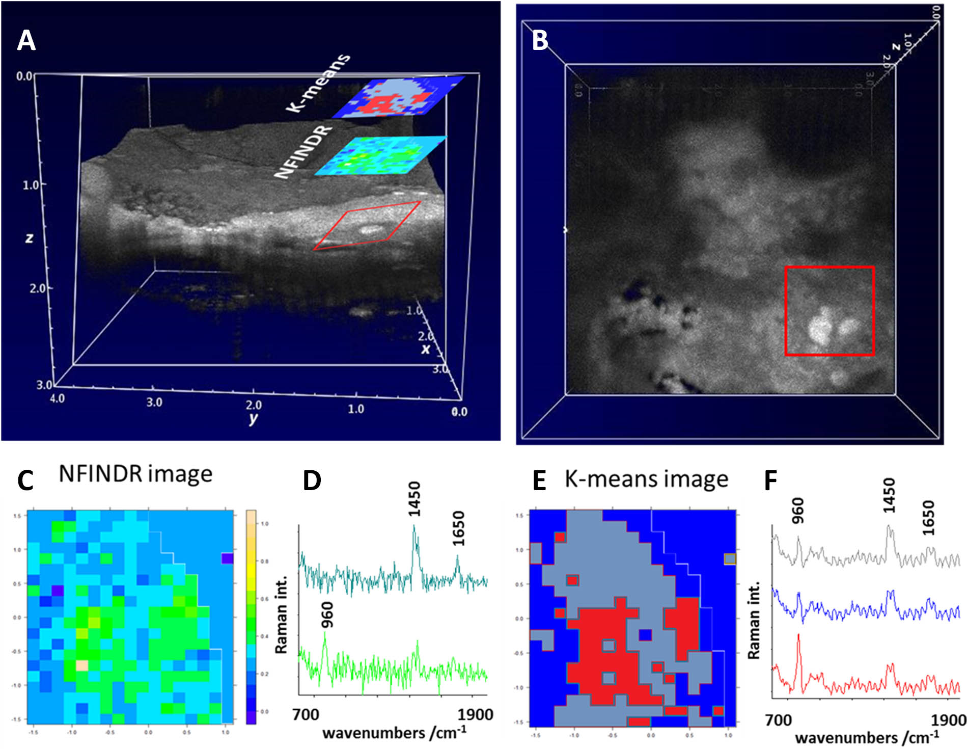 (Color online) OCT and Raman images of the calcified plaque deposition also shown in Figure 1. (A) and (B) OCT C and B scans of the aorta wall, whereby (B) shows the top view. The corresponding Raman images and the associated Raman spectra are shown in (C) and (D), as well as (E) and (F) for a value chain analysis (VCA) and K-means cluster analysis, respectively.