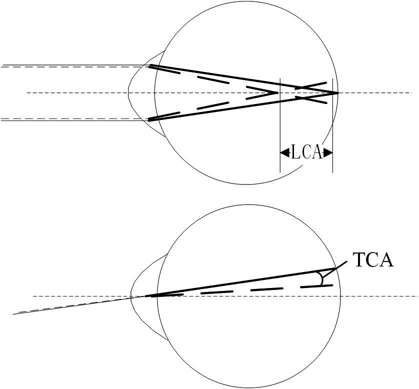 Schematic diagram of chromatic aberrations of human eyes. Short wavelength rays are shown by dashed lines, and long wavelength rays are solid lines.