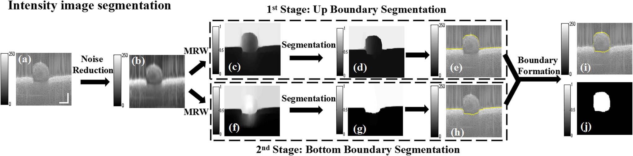 MRW algorithm segmentation procedure of intensity image. First stage shows the process of upper boundary segmentation. Second stage shows the process of bottom boundary segmentation. Then, they are combined to create an intact boundary mask (scale bar: 500 μm).