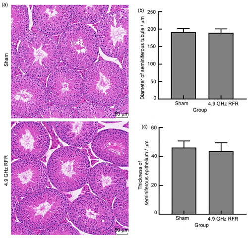 Effects of continuous exposure to 4.9 GHz RFR for 21 days on the morphological structure of seminiferous tubules in testis tissue of mice: (a) HE staining results of testis tissue, n=3; (b) diameter of seminiferous tubules; (c) thickness of seminiferous epithelium
