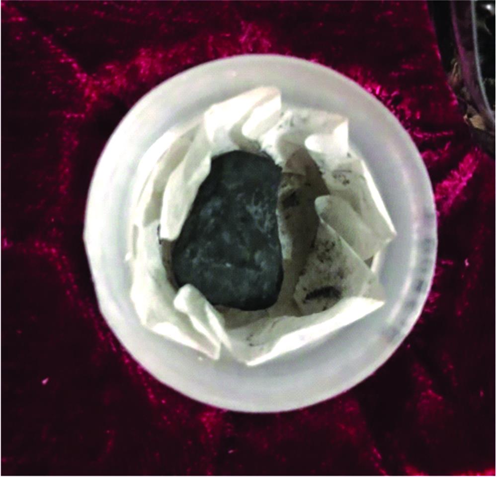 The ancient ink discovered in the tomb of Jiudian village, Jiangling County and presented in the Hubei Museum