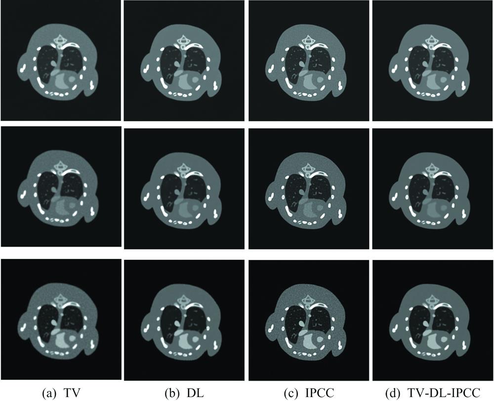 The reconstruction images of mouse thoracic cavity by four algorithms(a): TV; (b): DL; (c): IPCC; (d): TV-DL-IPCC From top to bottom, the rows are 1st, 2nd and 3rd energy channel