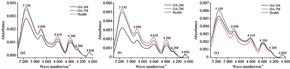 The near-infrared average spectra of healthy and multi-stage OA tissues at SZ(a), TZ(b), DZ(c), respectively