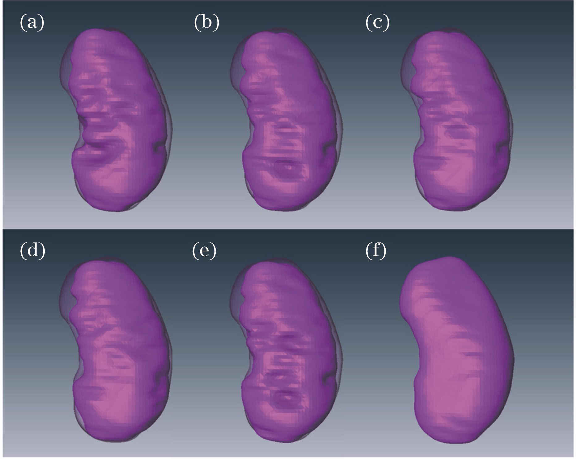 Left kidney image segmentation results obtained by different methods. (a) ASM1 method; (b) ASM2 method; (c) ASM3 method; (d) ASM4 method; (e) Snake method; (f) manual segmentation