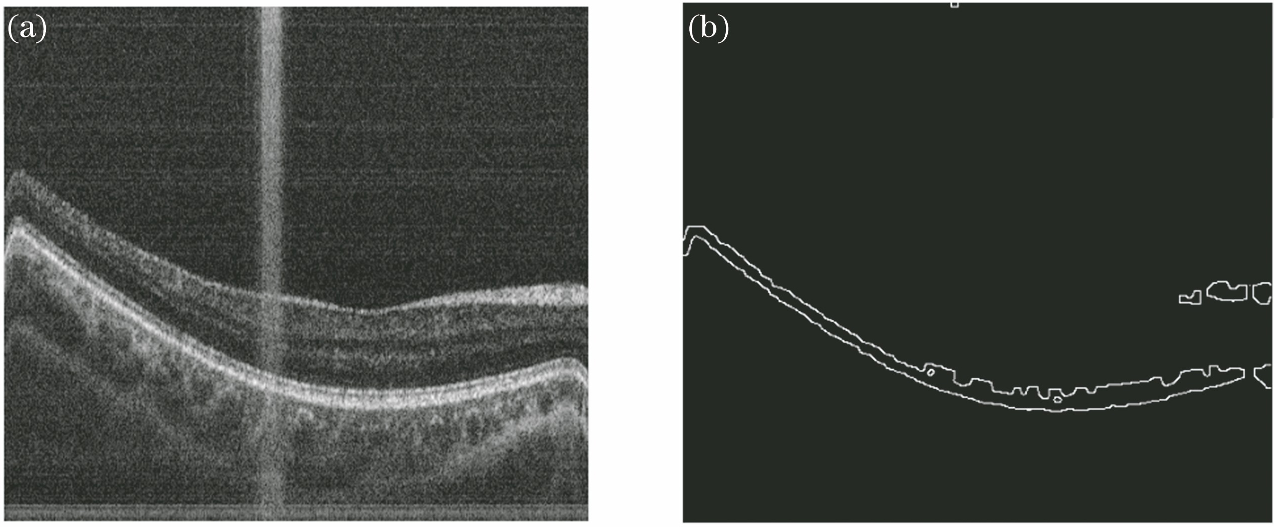 Extracting boundary of OCT image. (a) Original OCT retinal image; (b) boundary extracting image