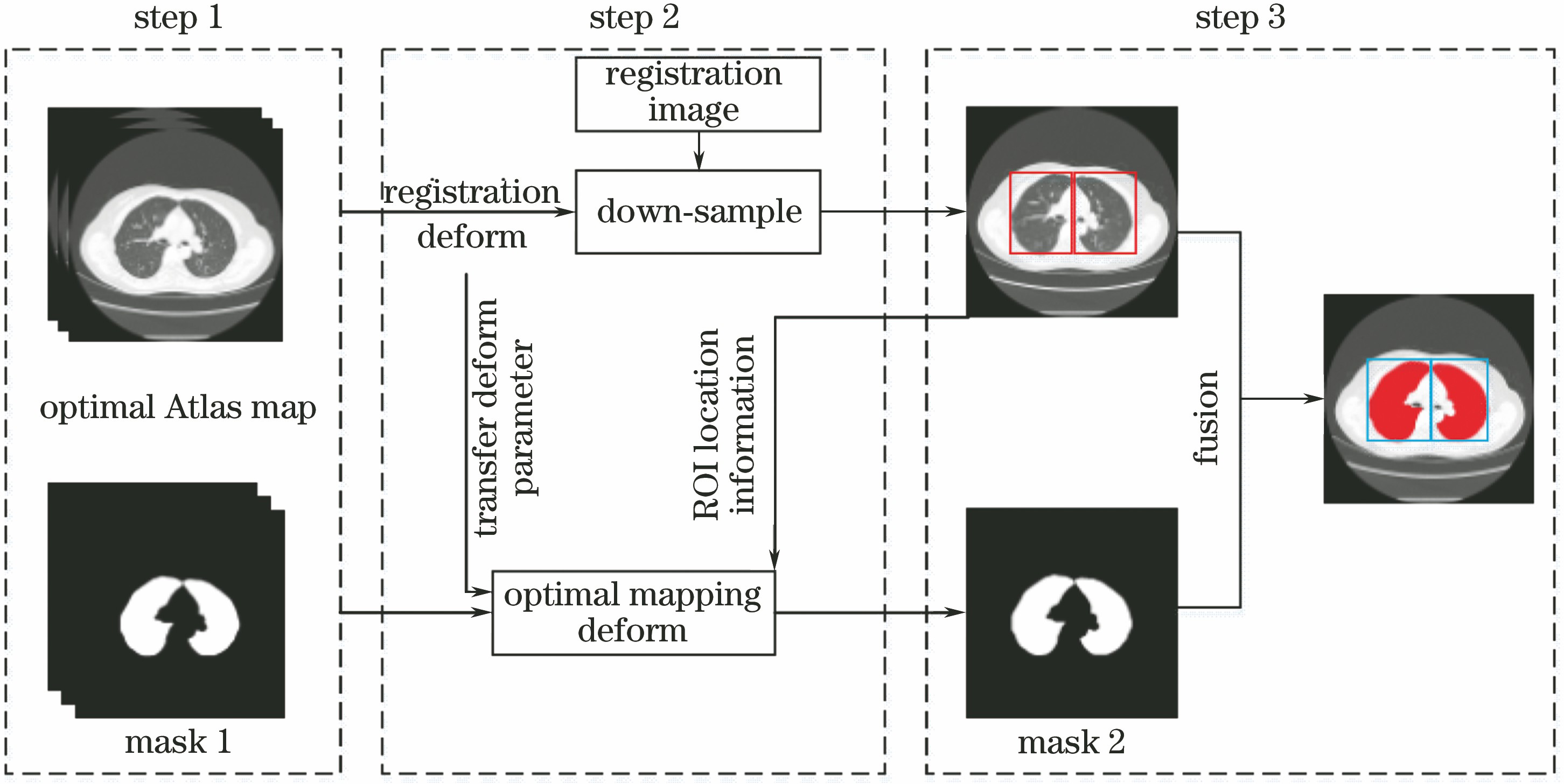 Framework of registration and segmentation