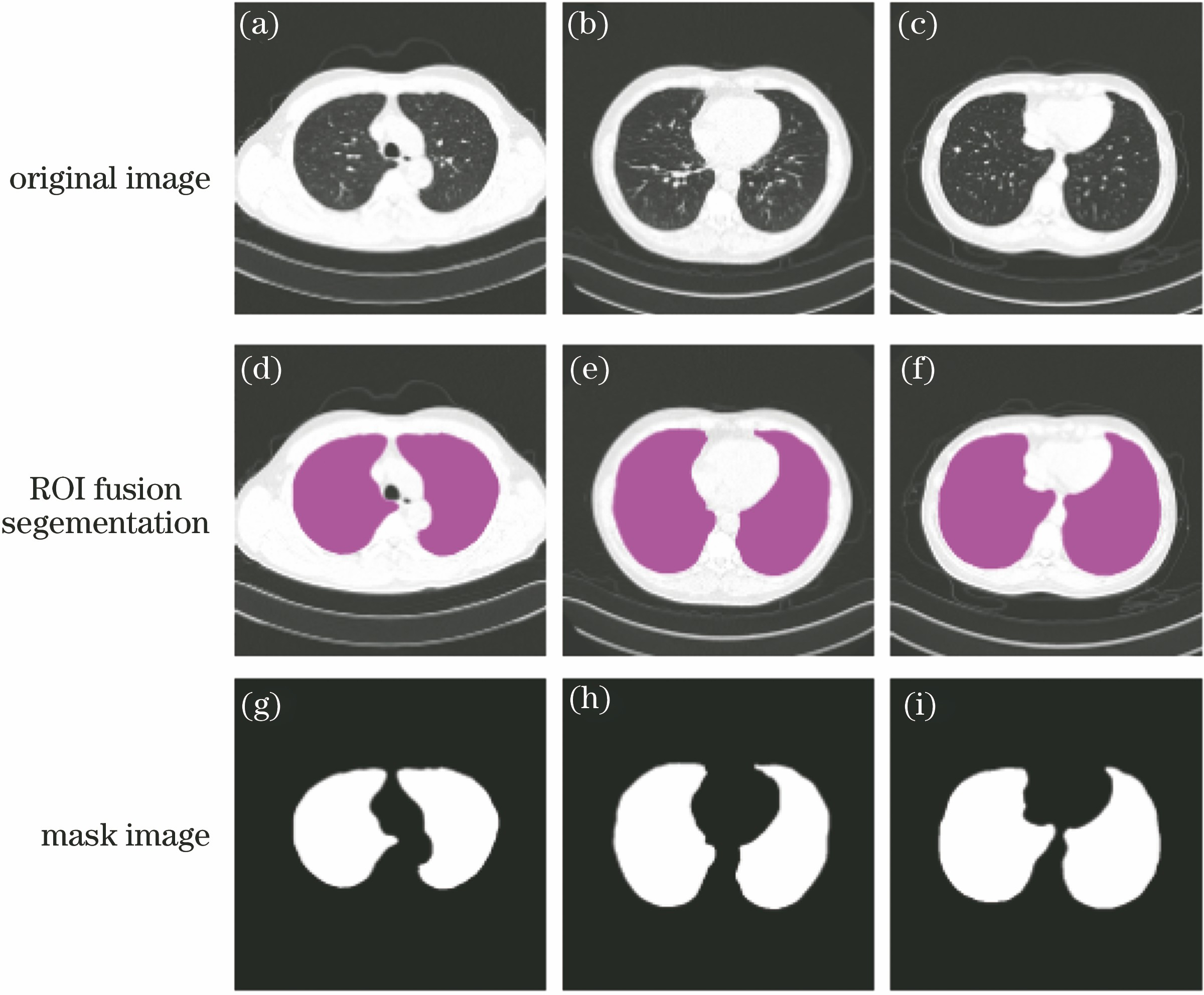 Regional fusion segmentation of lung tissues. (a)-(c) Images to be fused; (d)-(f) fusion and segmentation images; (g)-(j) binary images of mask