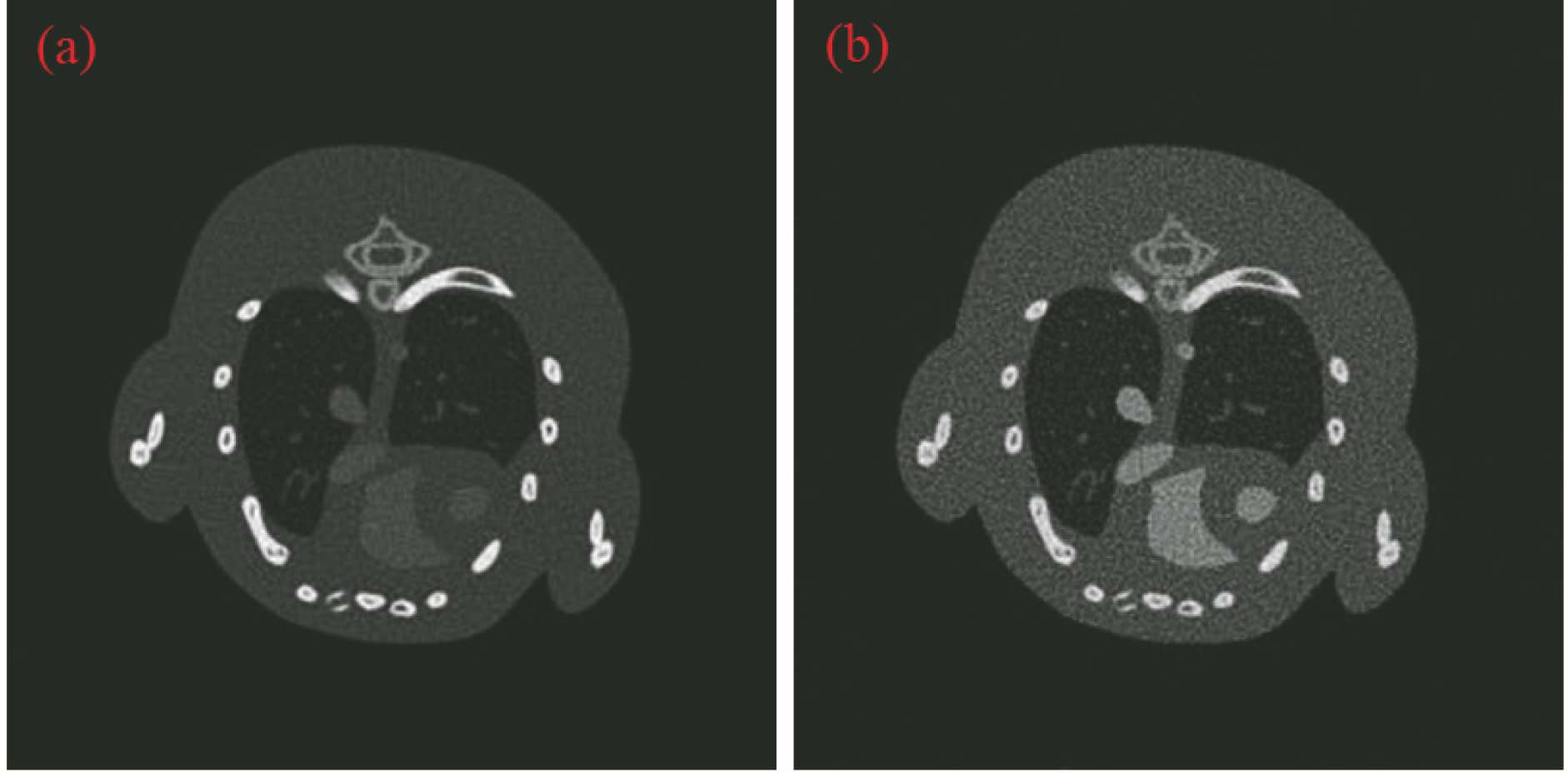 Reconstruction results of mouse thorax phantom by SIRT in high and low energies. (a) High energy reconstruction image; (b) low energy reconstruction image