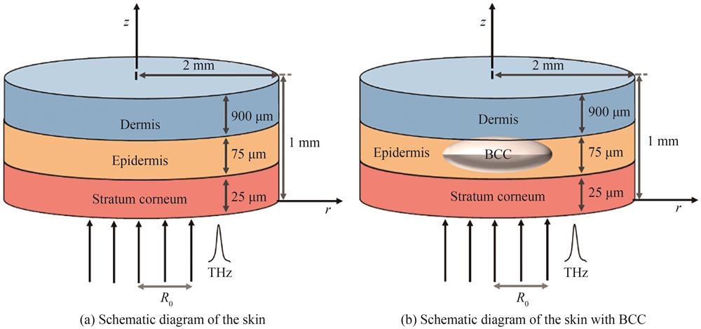 Schematic diagram of skin and skin structure with BCC