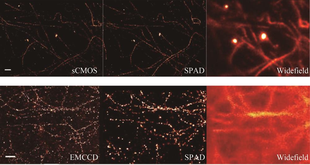 The comparison between the diffraction-limited images and the super-resolution images taken by a sCMOS，a SPAD array and an EMCCD［49］