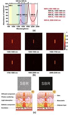 Clinical research progress on the fluorescence imaging in the second near-infrared window