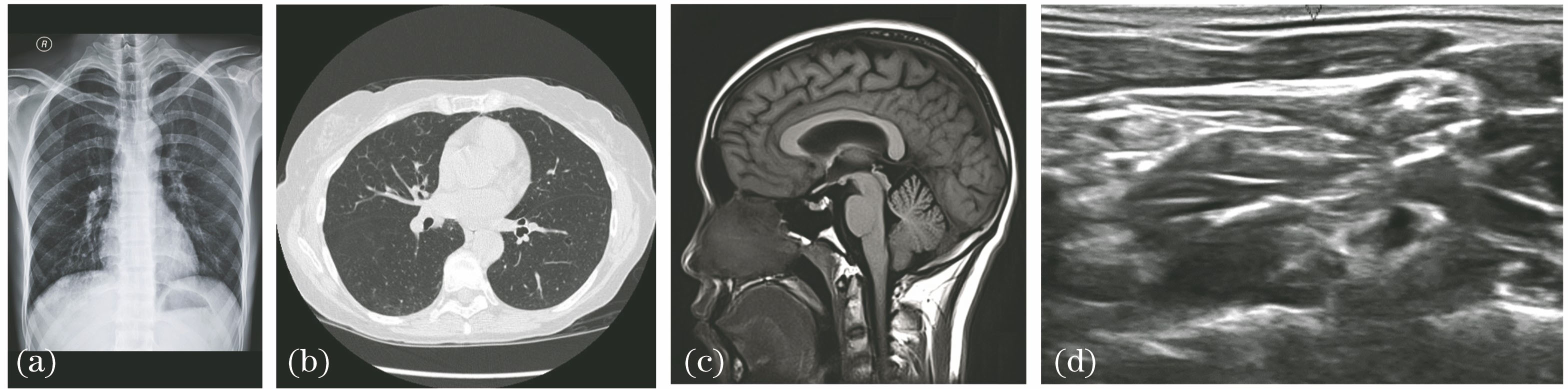 Images of typical medical. (a) X-ray image; (b) CT image; (c) MR image; (d) UI