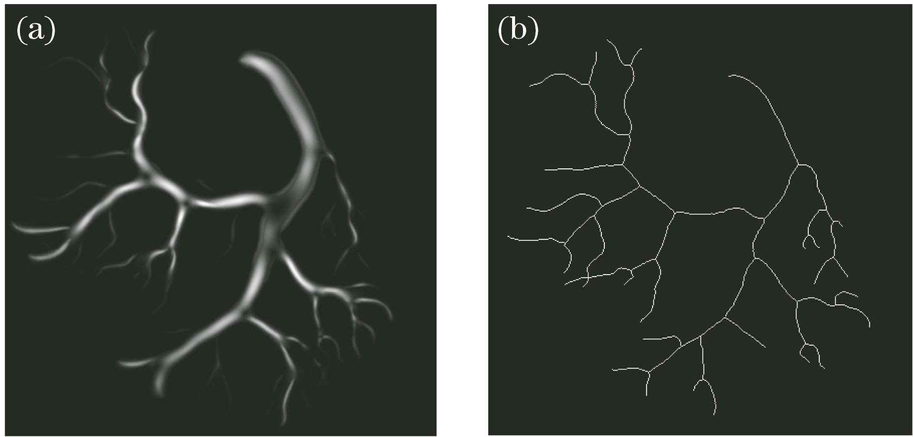 Extracted central axis of blood vessel. (a) Blood vessel after multi-scale self-adaptive filtering; (b) central axis of blood vessel