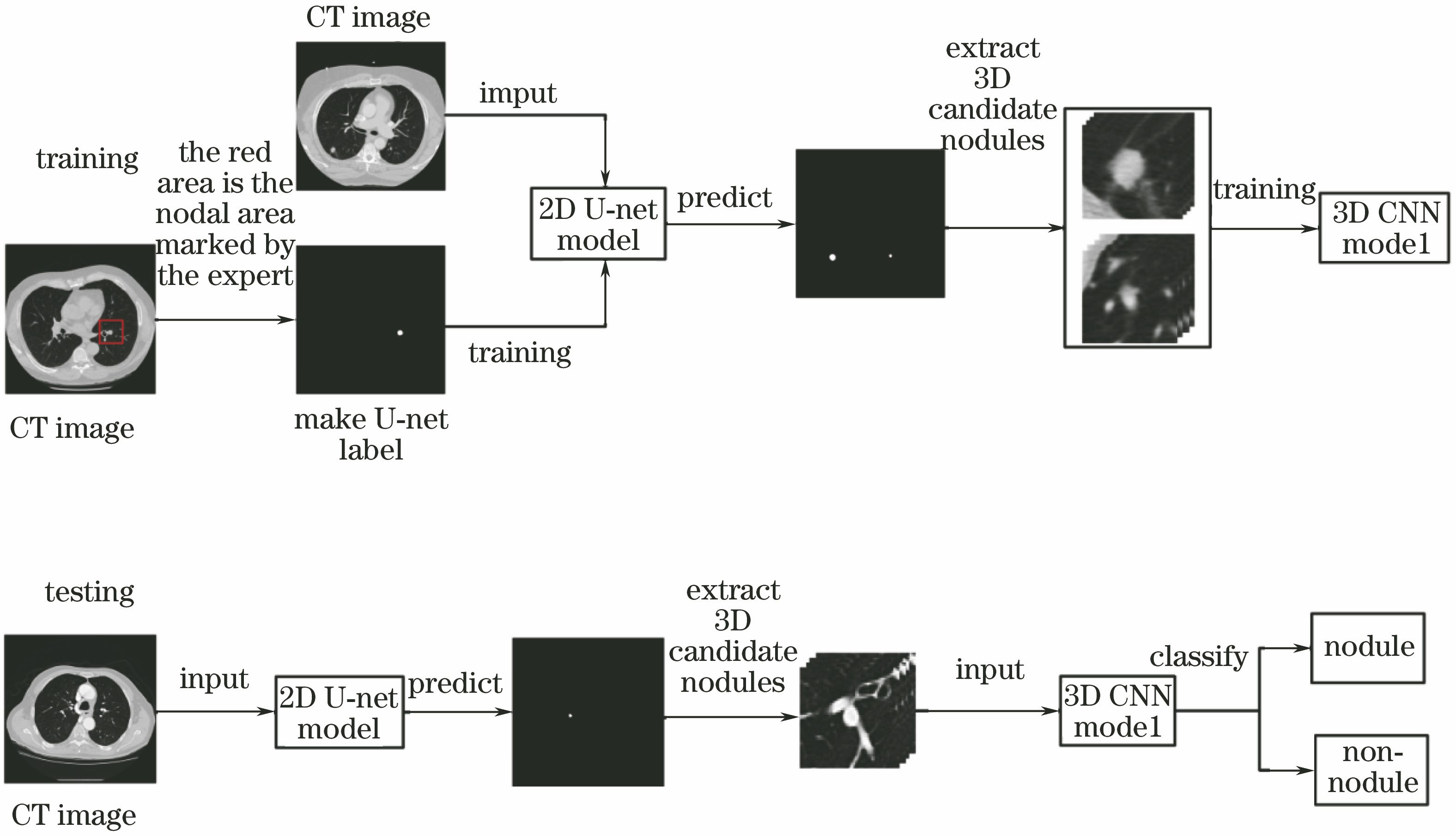 Flow chart of lung nodule detection system