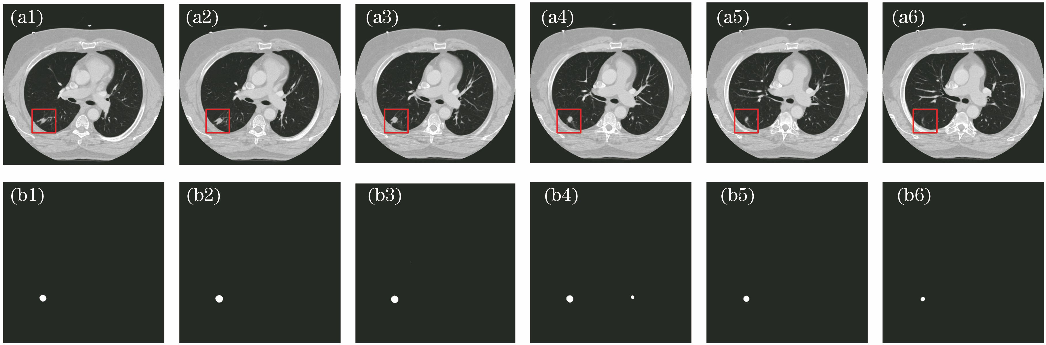 CT slice original images and U-net prediction images. (a) Original images; (b) prediction images