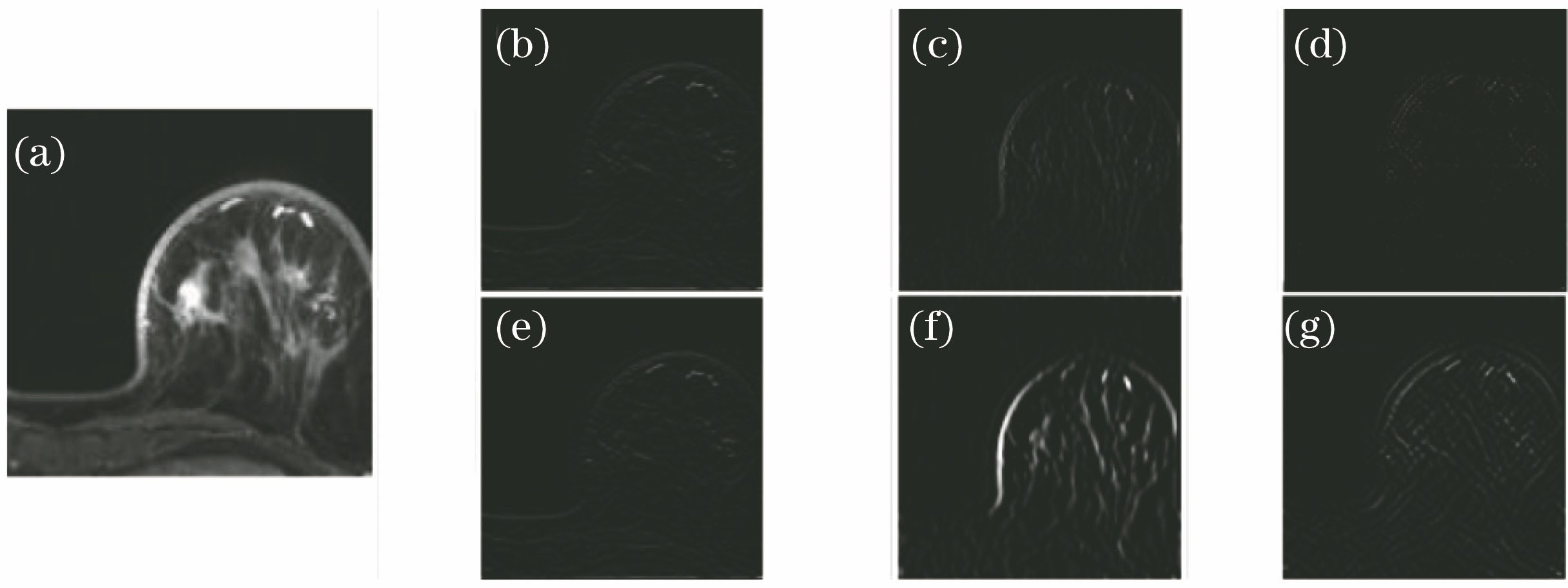 An example of stationary wavelet transform using db2 in internal dataset. (a) Original image; (b)-(d) horizontal, vertical, diagonal high frequency of 1-level SWT; (e)-(g) horizontal, vertical, diagonal high frequency of 2-level SWT