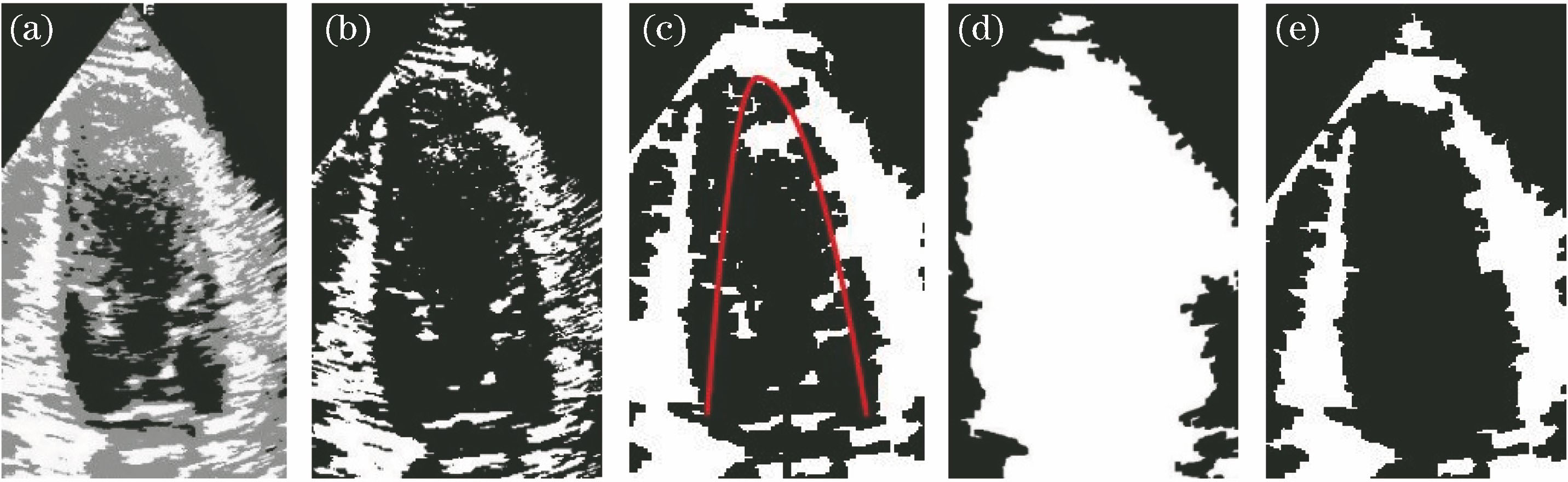 Result of binary image processing. (a) Segmentation result of three-phase Level Set; (b) take out results of white part of Fig. 1(a); (c) parabolic model; (d) left ventricular full filling image; (c) result of binary image processing