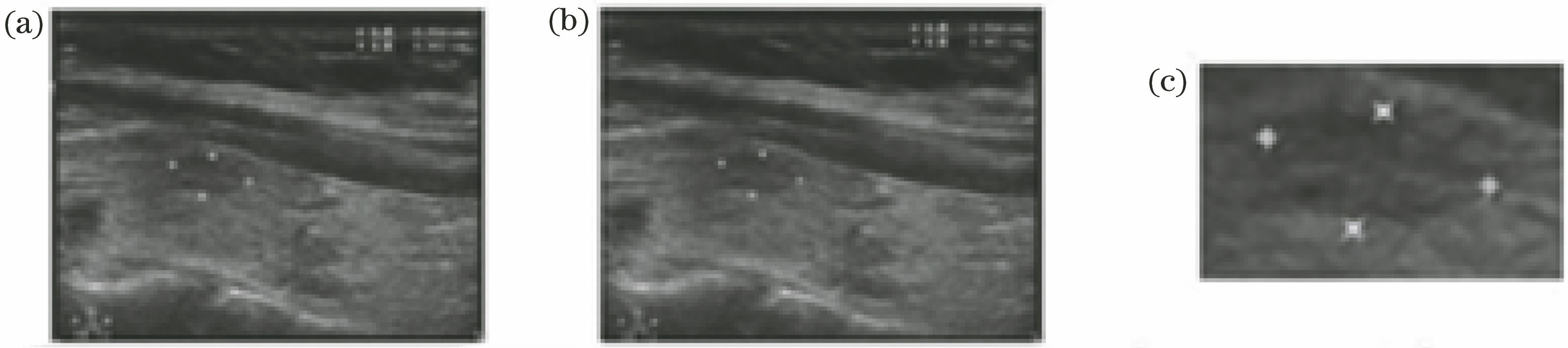 Ultrasound images of thyroid. (a) Original image; (b) noise-removal image; (c) region of interest