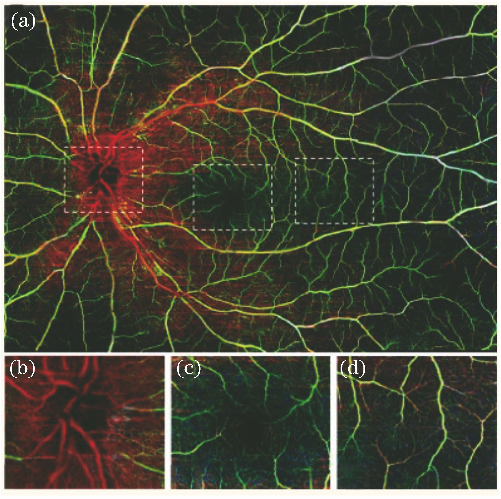 Angio-OCT images of human retina. (a) Large field of view (12 mm×16 mm) for Angio-OCT image of human retina; (b) optic nerve papilla image; (c) fovea image; (d) temporal region image (field of view is 2.0 mm×2.4 mm)[9]