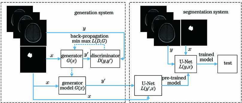 Overall framework of segmentation LGG
