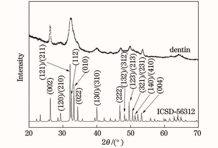 XRD pattern of dentin (dash line) and simulated XRD pattern of hydroxyapatite from ICSD-56312 (solid line)