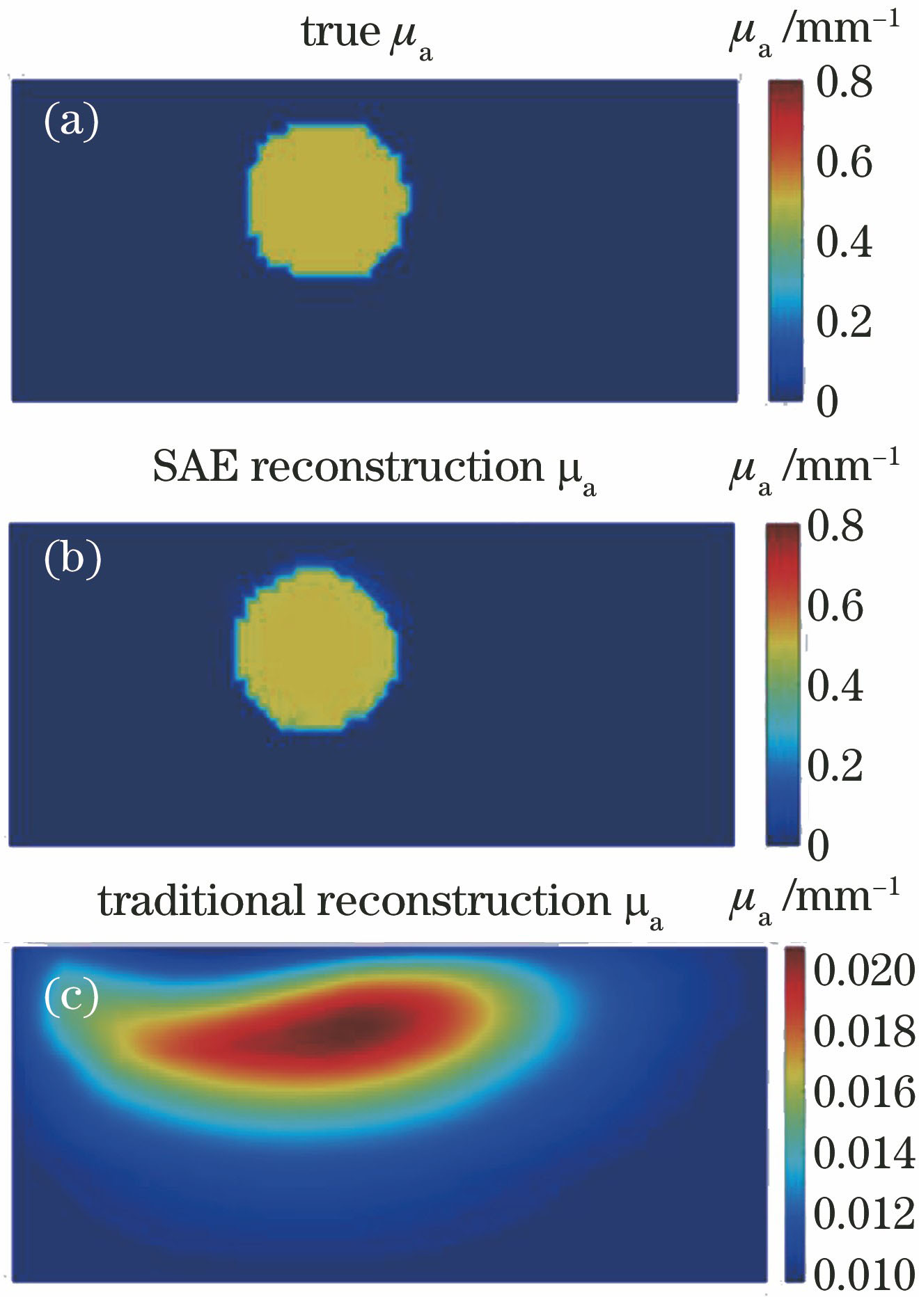 Comparison of deep learning reconstruction and traditional iterative reconstruction