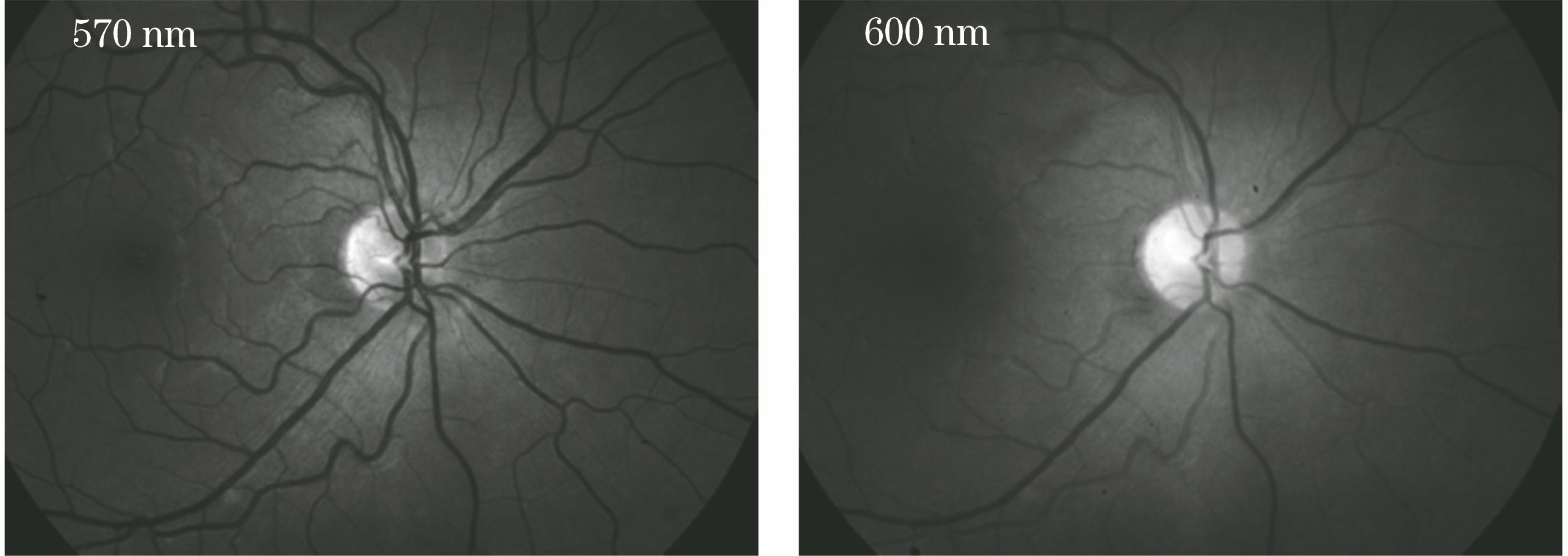 Fundus images at wavelengths of 570 nm and 600 nm
