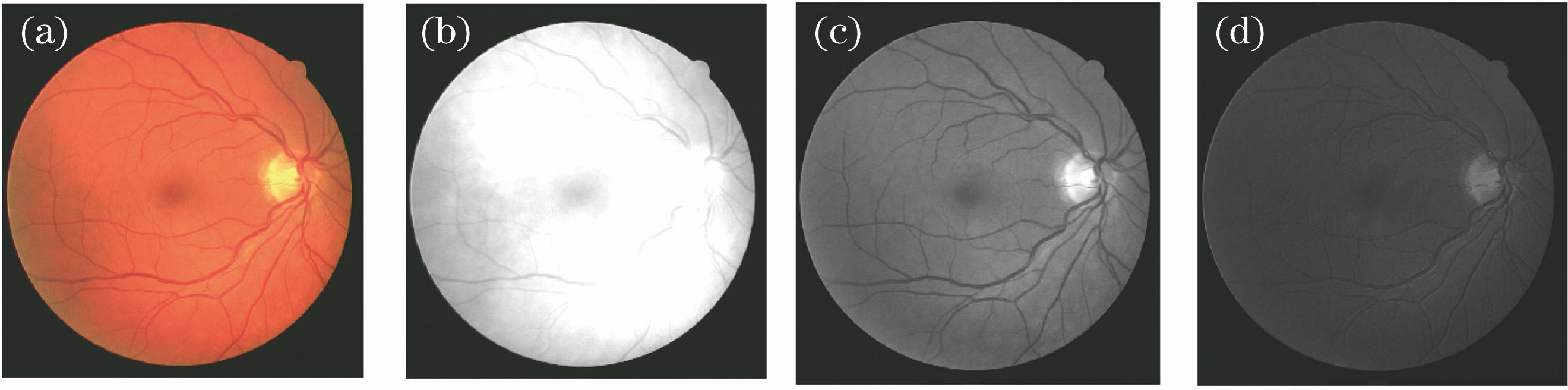 Comparison of extracted results of green channel and other channels. (a) Color fundus image; (b) red channel; (c) green channel; (d) blue channel