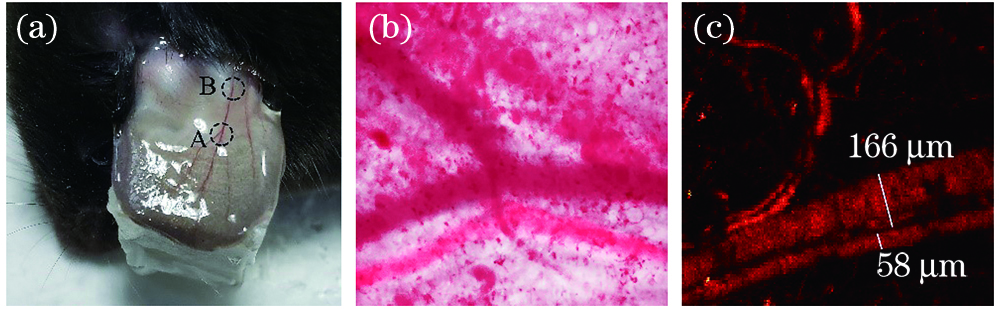 Pictures of mouse ear. (a) Photograph of vessels in mouse ear; (b) optical microimaging of vessels at the bifurcation of mouse ear; (c) photoacoustic imaging of vessels at the root of mouse ear