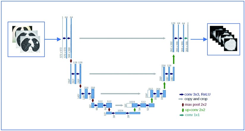 Schematic diagram of segmentation of lung nodules by U-Net