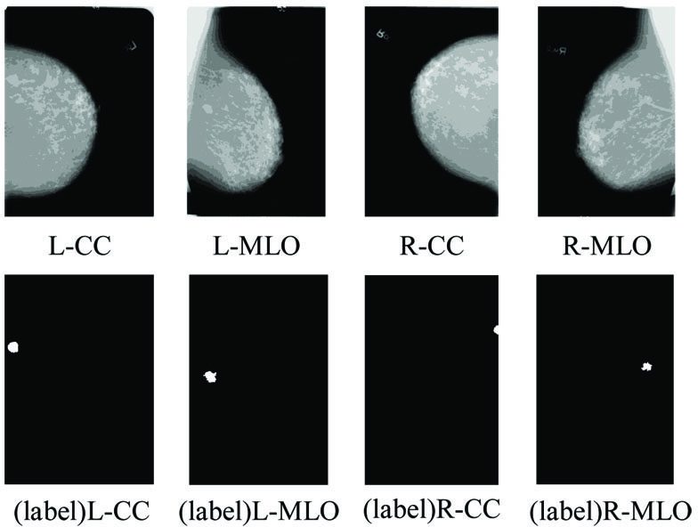 Mammograms and the pixel-level lesion labels of different views (L-CC, L-MLO, R-CC and R-MLO) from CBIS-DDSM dataset