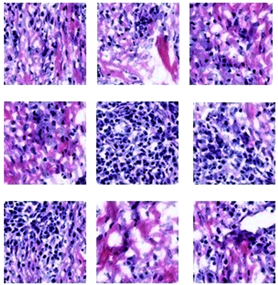 Histopathological patches after image preprocessing