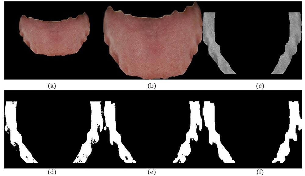 Preprocessing process of tooth-marked tongue image. (a) Tongue image after segmentation; (b) smallest rectangular containing tongue; (c) tooth mark part extraction image; (d) tooth mark region binarization; (e) image after opening and closing operation; (f) image after contour filling