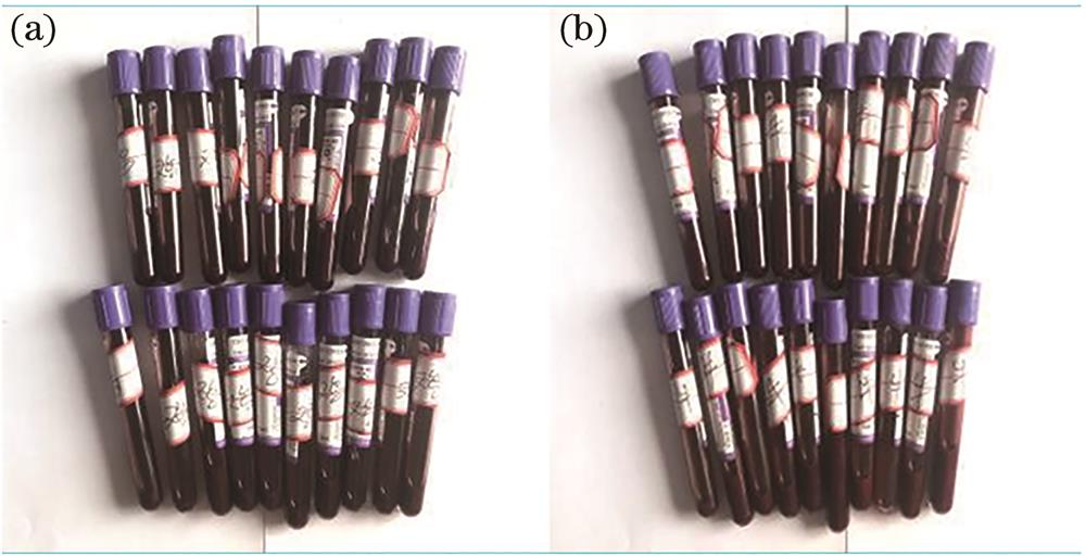 Chicken blood and bovine blood used in experiment. (a) Chicken blood; (b) bovine blood