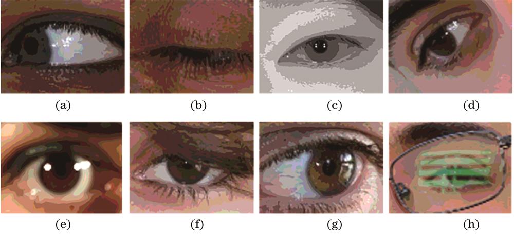 Examples of eye image acquisition in complex scenes. (a) Gaze deviation; (b) absence of iris; (c) eyelash occlusion; (d) iris rotation; (e) blur; (f) hair shade; (g) specular reflection; (h) glasses occlusion