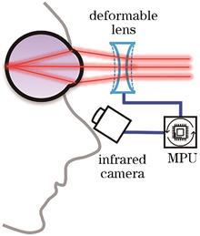 Developing Dynamic Compensation System for Eye Defocus Based on Image Processing