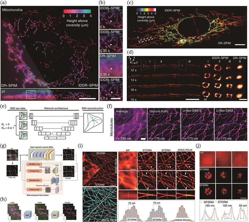 (a)‒(d) Deep learning enables light sheet fluorescence microscopy to break through the diffraction limit and improving the spatial resolution of imaging, the spatial resolution and time series results of DR-SPIM (uncombined deep learning method) and IDDR-SPIM (combined deep learning method) are displayed and compared[29]; (e) (f) deep learning enables structured light microscopy to improve imaging temporal resolution, the figures contain schematic diagrams and reconstruction results for microtubules[30]; (g)‒(j) deep learning enables single-molecule localization microscopy to improve imaging temporal resolution, the figures contain schematic diagrams and comparisons with other methods[34]