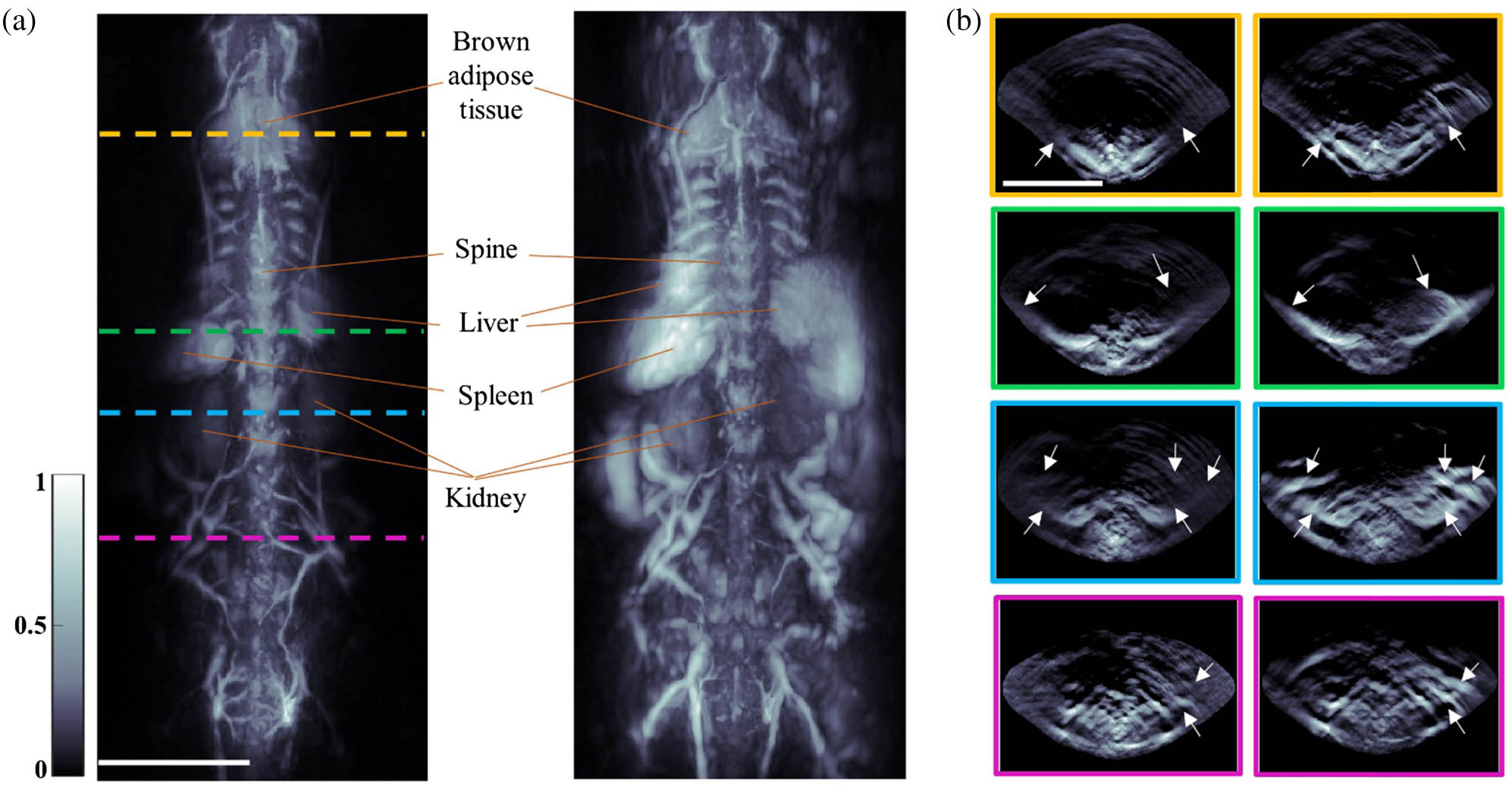 In vivo comparison study between the single-beam and multibeam illumination approaches. (a) Images reconstructed after single vertical sweeps using single-beam (left) and multibeam (right) illuminations. (b) Fluence corrected cross-sectional reconstructions (MIPs over 1 mm thickness) at several anatomical positions along the animal: (left) using single-beam and (right) using multibeam illumination. Arrows point to the differences. Scale bar: 1 cm.