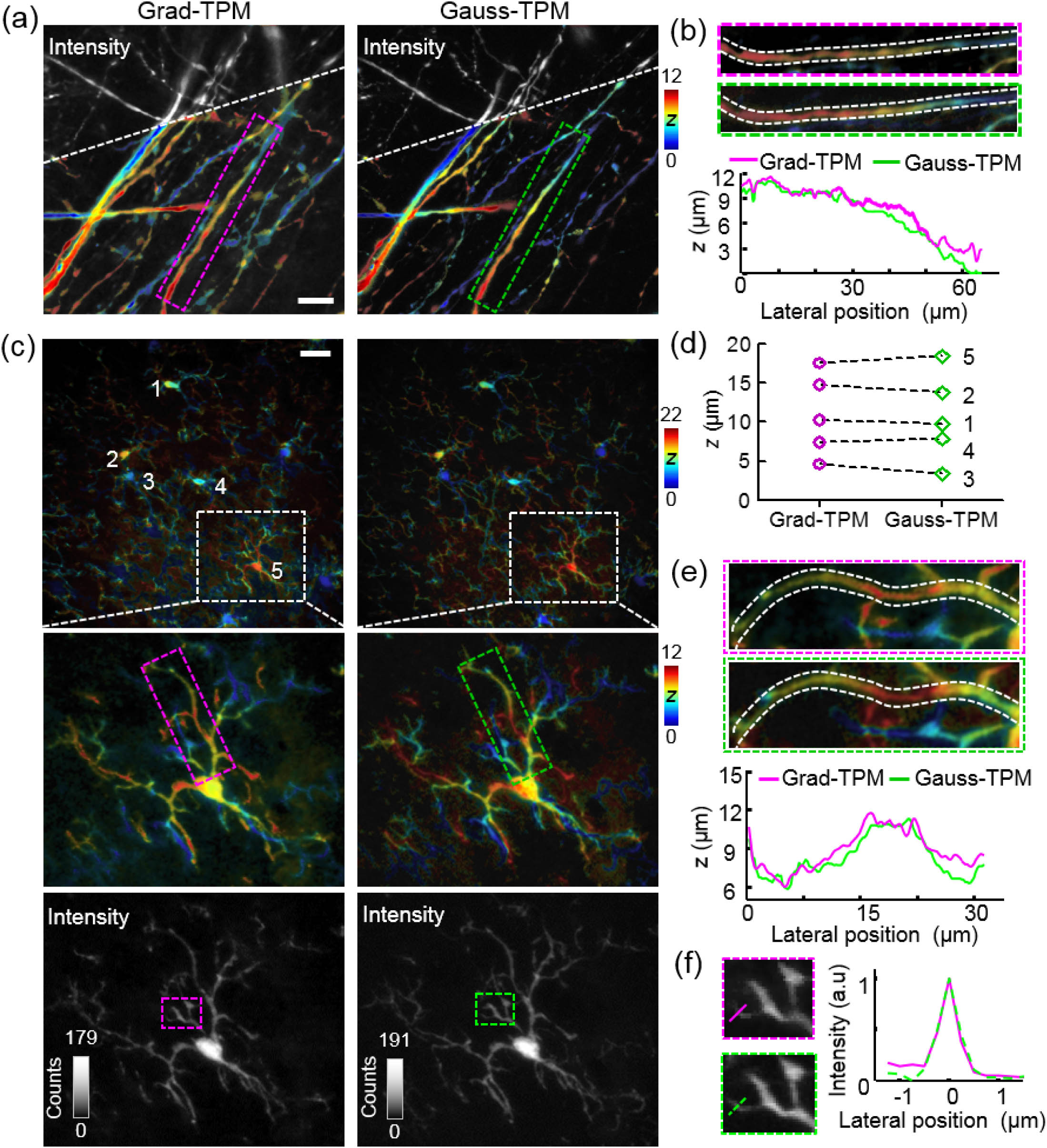 Grad-TPM images of various biological structures show depth resolution and intensity contrast resembling those acquired with Gauss-TPM imaging. (a) Axons in brain slice of Thy1-GFP transgenic mouse. (b) Higher magnification views of boxed axon in (a), and depth profiles along central axis of axon. (c) Microglia in brain slice of CX3CR1-GFP transgenic mouse. First row, stitched images of two axially adjacent volumes (0–22 μm depth); second row, separate images of the upper volume (0–12 μm depth); third row, intensity images corresponding to images in the second row. (d) Depths of microglia cell bodies denoted by 1–5 in images in the first row of (c). (e) Higher magnification views of boxed microglia process in the second row of (c), and depth profiles along central axis. (f) Higher magnification views of boxed areas in the third row of (c) and corresponding intensity profiles along dashed lines for lateral resolution demonstration. Scale bars, 20 μm. Units of z, μm.
