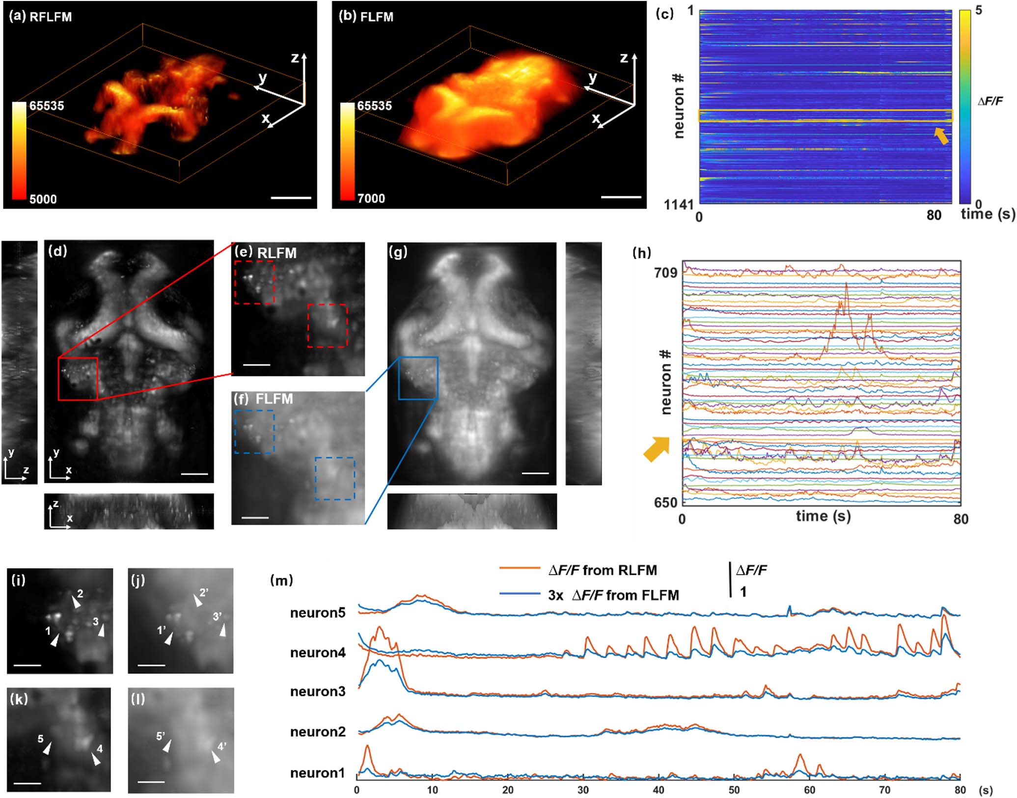 High-contrast volumetric imaging of neural network activity in the brains of larval zebrafish in vivo. The imaging depth is centered at about tens of microns below the brain surface of the zebrafish. (a) and (b) Maximum intensity projects (MIPs) over recording time in the 4D (x–y–z–t) domain, captured by RFLFM and FLFM modes, respectively. Scale bar: 150 μm. (c) Fluorescence signals of neurons, based on RFLFM reconstructed images. The activity shows a visible increase at about 57 s and 75 s. (d) 3D projection of (a) in different orthogonal planes. Scale bar: 60 μm. (g) 3D projection of (b) in different orthogonal planes. Scale bar: 60 μm. (e) and (f) Zoom-in views of the regions in boxes of (d) and (g), respectively. Scale bar: 20 μm. (h) Zoom-in view of orange box indicating the activity of 60 neurons in (c). (i)–(l) Zoom-in views of the regions in boxes of (e) and (f), where the arrows indicate the neurons. Scale bar: 10 μm. (m) Calcium tracings of five neurons, indicated in (i)–(l). The orange line indicates signals achieved in RFLFM and the blue line indicates signals enlarged three times achieved in FLFM.