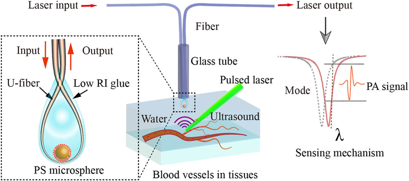 Concept of the optical microcavity ultrasound probe. A schematic diagram of PA detection is shown in the figure, where ultrasound waves are generated by blood vessels in the tissue excited by pulsed light and then detected using our microprobe. The detailed enlarged diagram of the probe is given in the figure on the left. The mechanism of the ultrasound detection is shown on the right side of the figure.