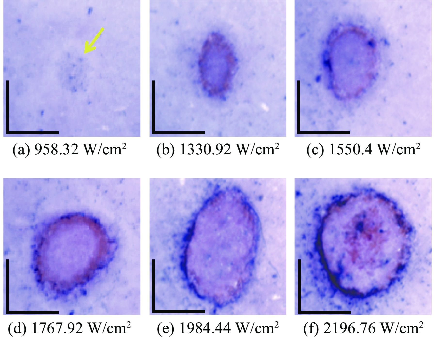 Dermoscope images of injury in mice skin at different duration of 1064 nm laser irradiation (400 ms after irradiation; scale bar of dermoscope images: 1 mm)