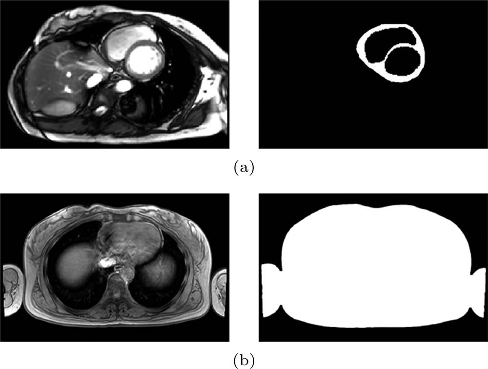 Image segmentation of MRI slices: (a) Heart; (b) torsoMRI切片的图像分割 (a) 心脏; (b) 躯干